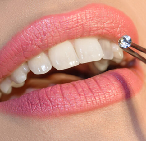 Tooth Gems Course