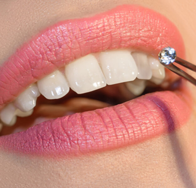 Tooth Gems Course