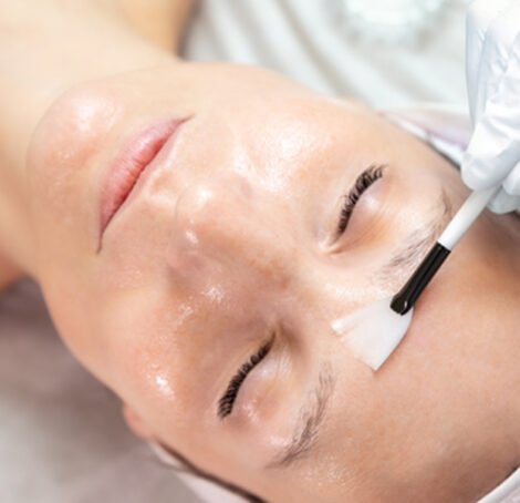 Chemical Peels Course